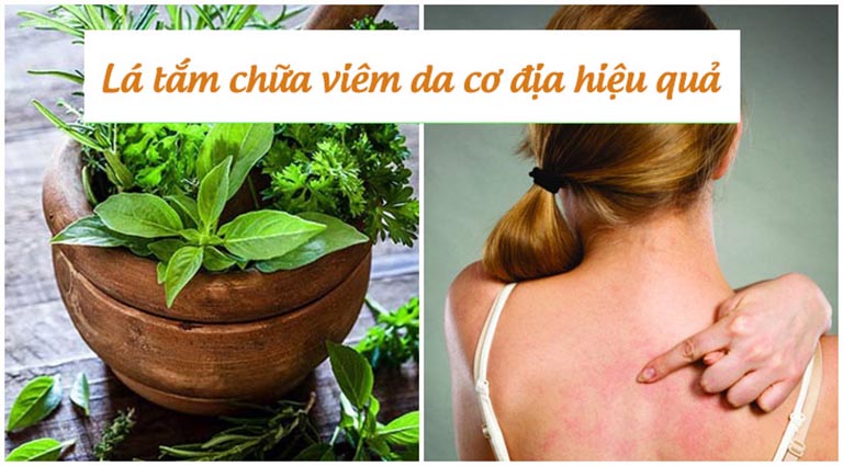 Viêm da cơ địa tắm lá gì tốt?