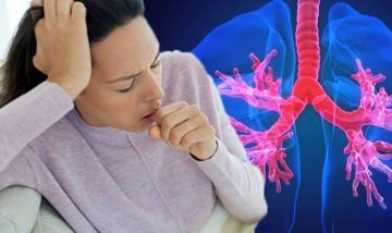 Bệnh hen phế quản: Nguyên nhân, Triệu chứng, Cách điều trị