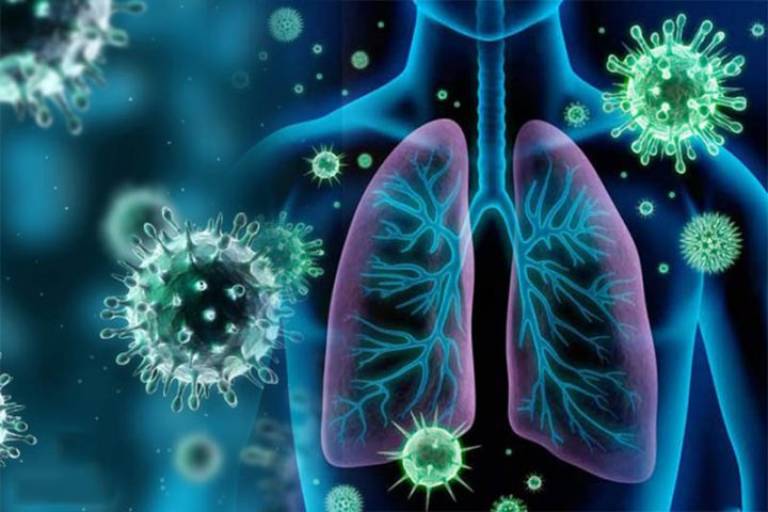 Nguyên nhân dẫn đến viêm phổi phế quản phổi
