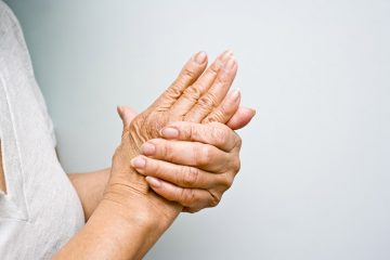 viêm khớp dạng thấp