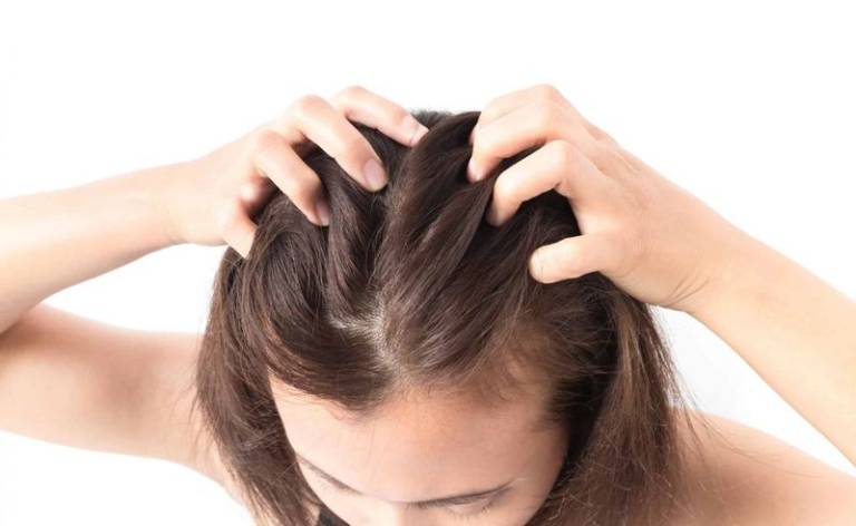 Nấm da đầu còn có tên gọi khác là giun gai, đây là bệnh da liễu thường gặp ở nhiều đối tượng và độ tuổi khác nhau