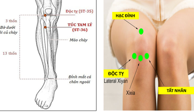 Hướng dẫn cách bấm huyệt chữa tràn dịch khớp gối