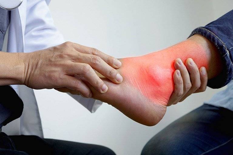 Một số lưu ý khi dùng thuốc điều trị bệnh gout