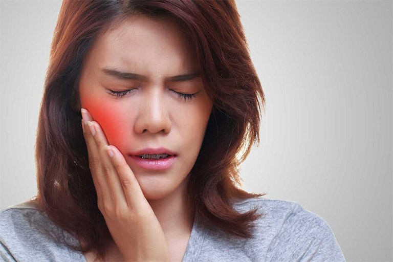 Châm cứu hoặc day bấm huyệt Giáp Xa giúp giảm đau răng