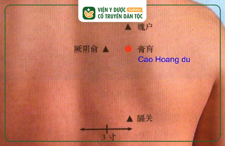 Huyệt Cao Hoang là huyệt đạo quan trọng, có tác dụng điều trị nhiều bệnh lý