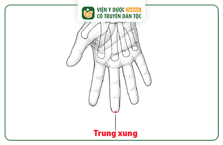 Huyệt Trung Xung Là Gì? Công Dụng Và Lưu Ý Khi Châm Cứu