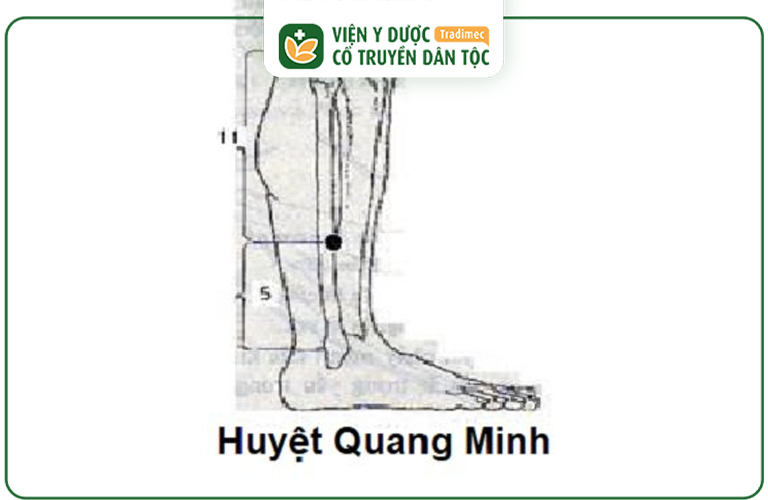 Huyệt Quang Minh giúp cải thiện nhiều bệnh tật