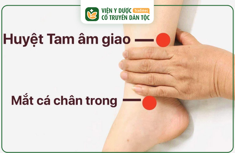 Kết hợp huyệt Đới Mạch với Tam Âm Giao