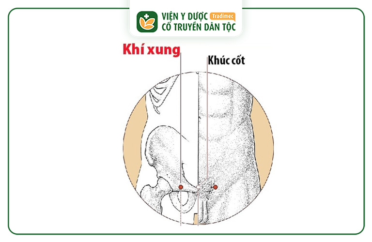 Hình ảnh minh họa huyệt đạo Khí Xung