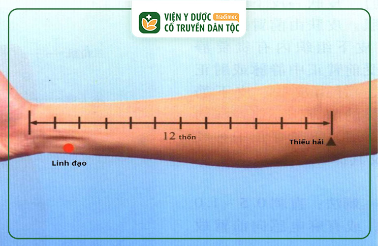 Huyệt Linh Đạo nằm ở mặt trước trong cẳng tay