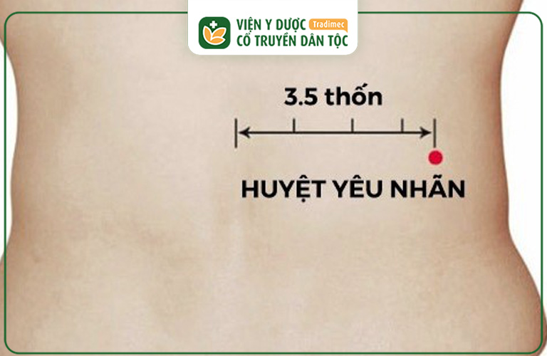 Huyệt Yêu Nhãn giúp điều trị các bệnh lý như đau lưng, đau thắt lưng