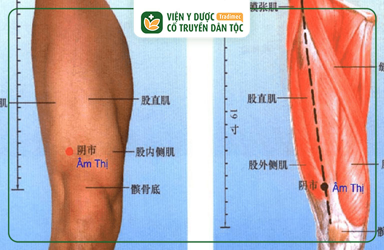 Hình ảnh minh họa huyệt đạo Âm Thị