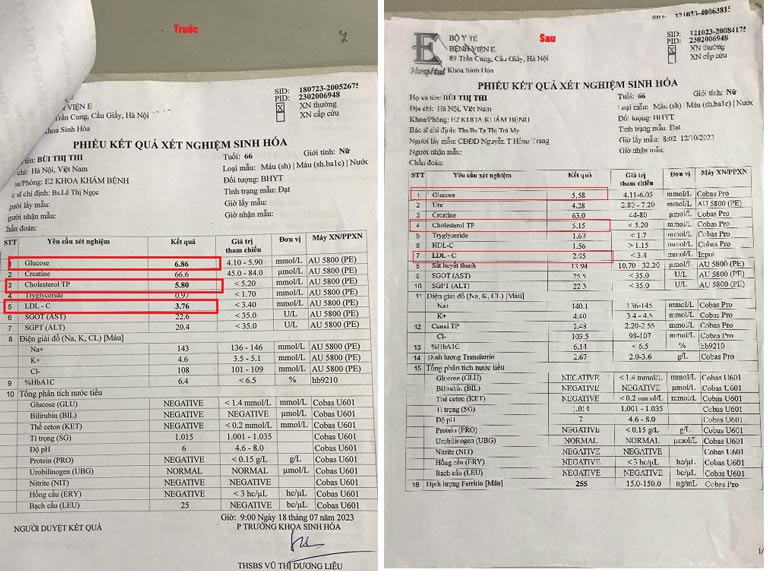 Kết quả xét nghiệm trước và sau khi điều trị mỡ máu của bệnh nhân Bùi Thị Thi