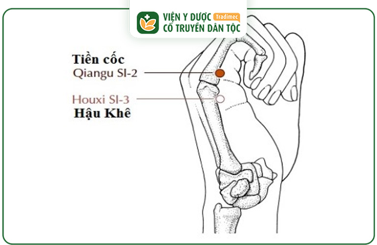 Vị trí của huyệt Tiền Cốc trên cơ thể