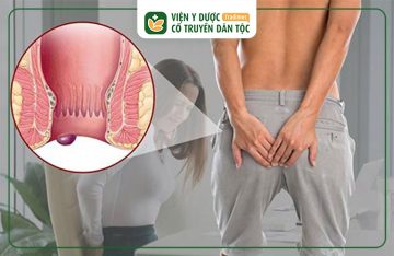 Hậu Môn Bị Lồi Thịt Đau Rát Là Bệnh Gì? Chẩn Đoán Và Điều Trị