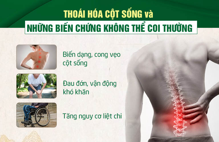 Đừng chủ quan với thoái hóa xương khớp