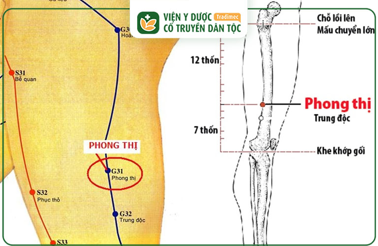 Vị trí của huyệt Trung Độc trên cơ thể