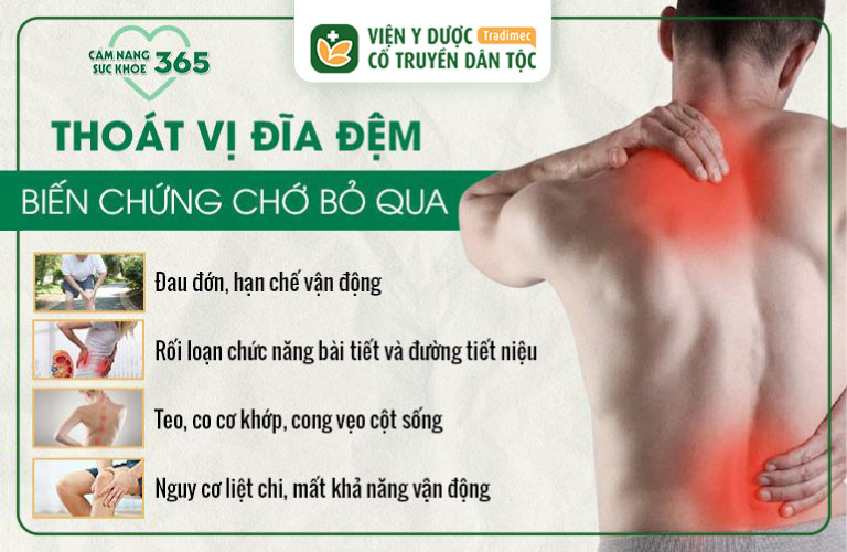 Cảnh báo biến chứng thoát vị đĩa đệm