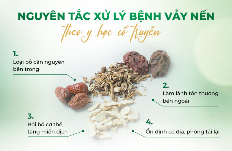 Nguyên tắc xử lý bệnh vảy nến theo y học cổ truyền