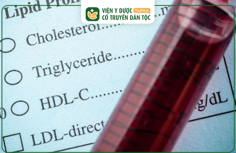 Tổng lượng cholesterol toàn phần dưới 200 mg/dL được coi là lý tưởng