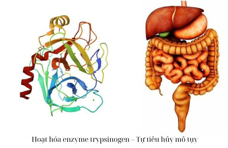 Hoạt hóa enzyme trypsinogen – Tự tiêu hủy mô tụy