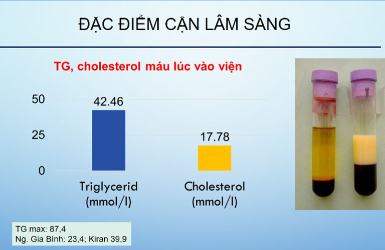 Đặc điểm cận lâm sàng khi tăng triglyceride máu