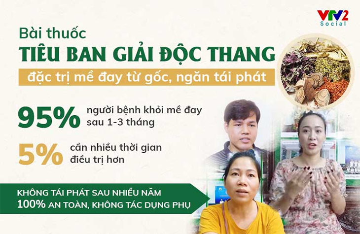 Tỷ lệ điều trị thành công bệnh mề đay